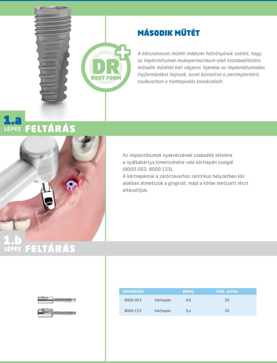 a FELTÁRÁS Az implantátumok nyakrészének szabaddá tételére a nyálkahártya kimetszésére való körtrepán szolgál (8000-053, 8000-153).