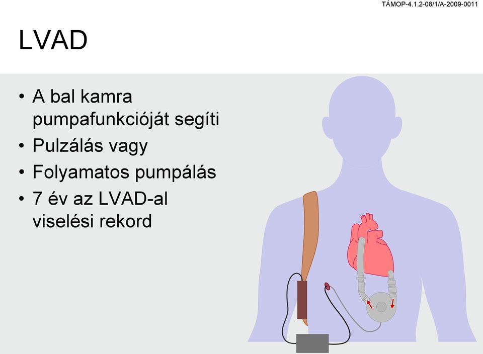 Pulzálás vagy Folyamatos