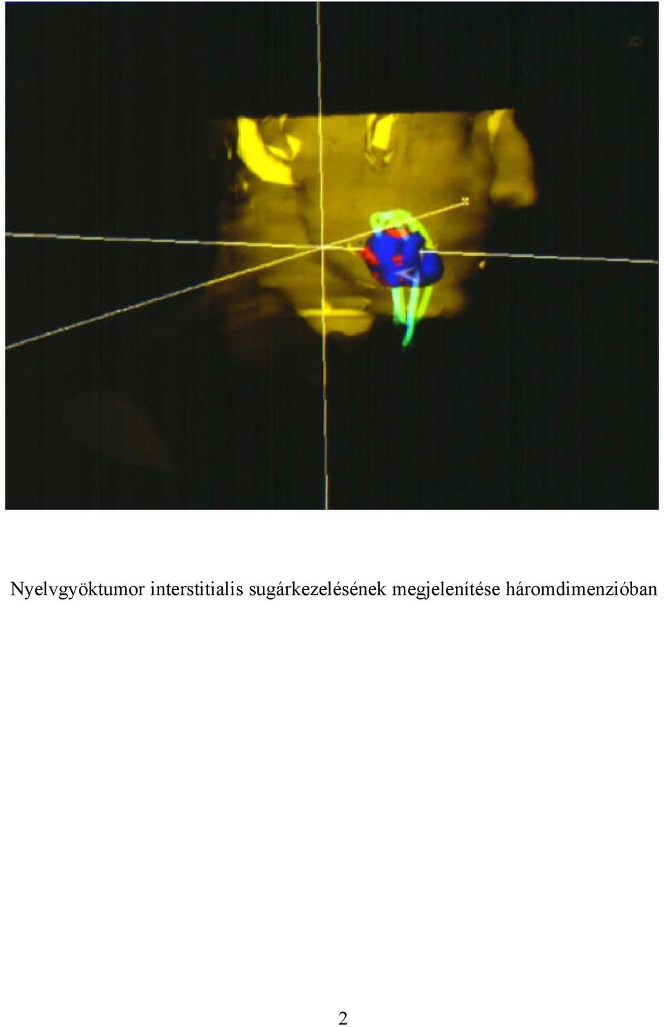 sugárkezelésének