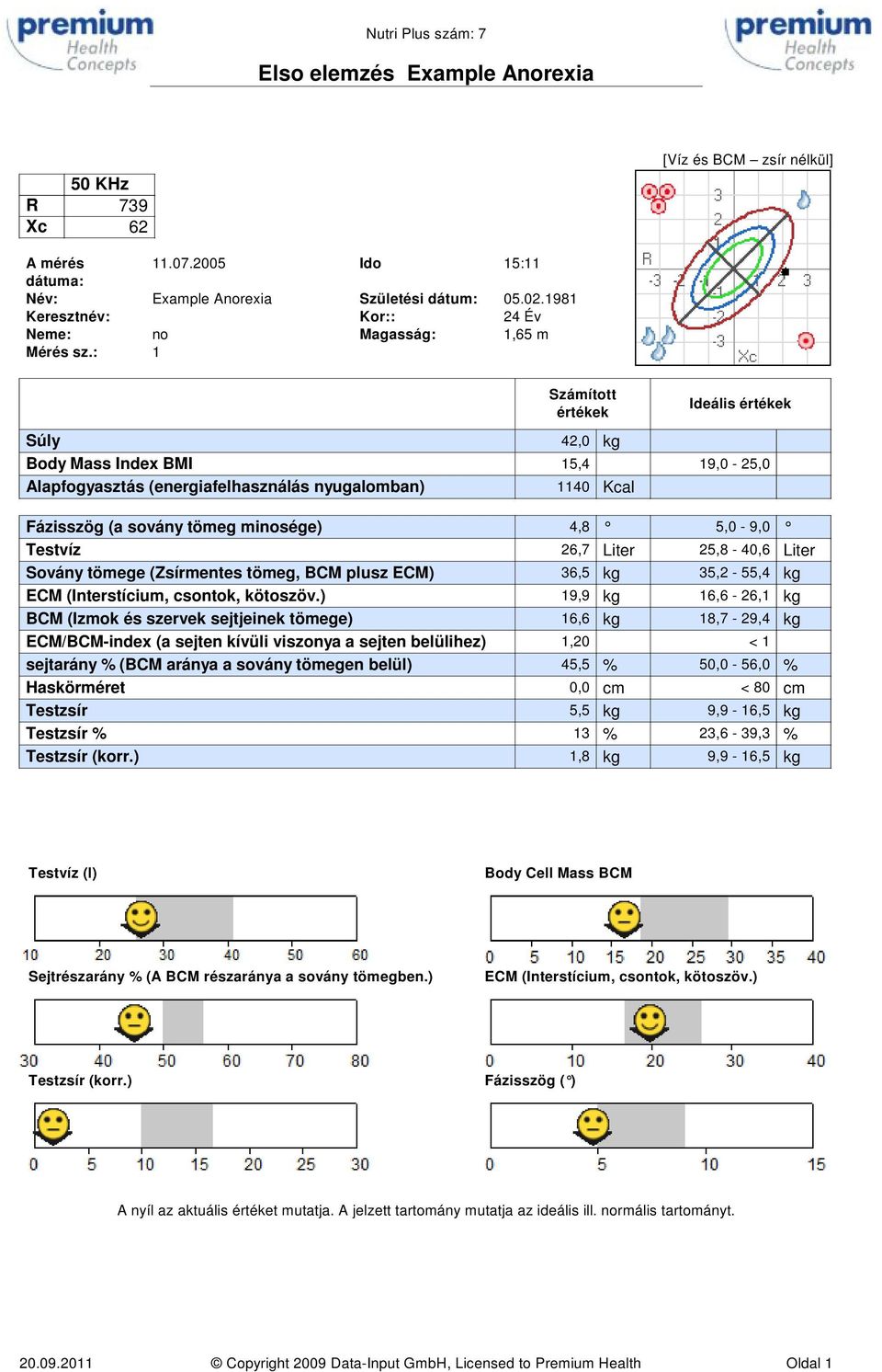 Testvíz 26,7 Liter 25,8-40,6 Liter Sovány tömege (Zsírmentes tömeg, BCM plusz ECM) 36,5 kg 35,2-55,4 kg ECM (Interstícium, csontok, kötoszöv.