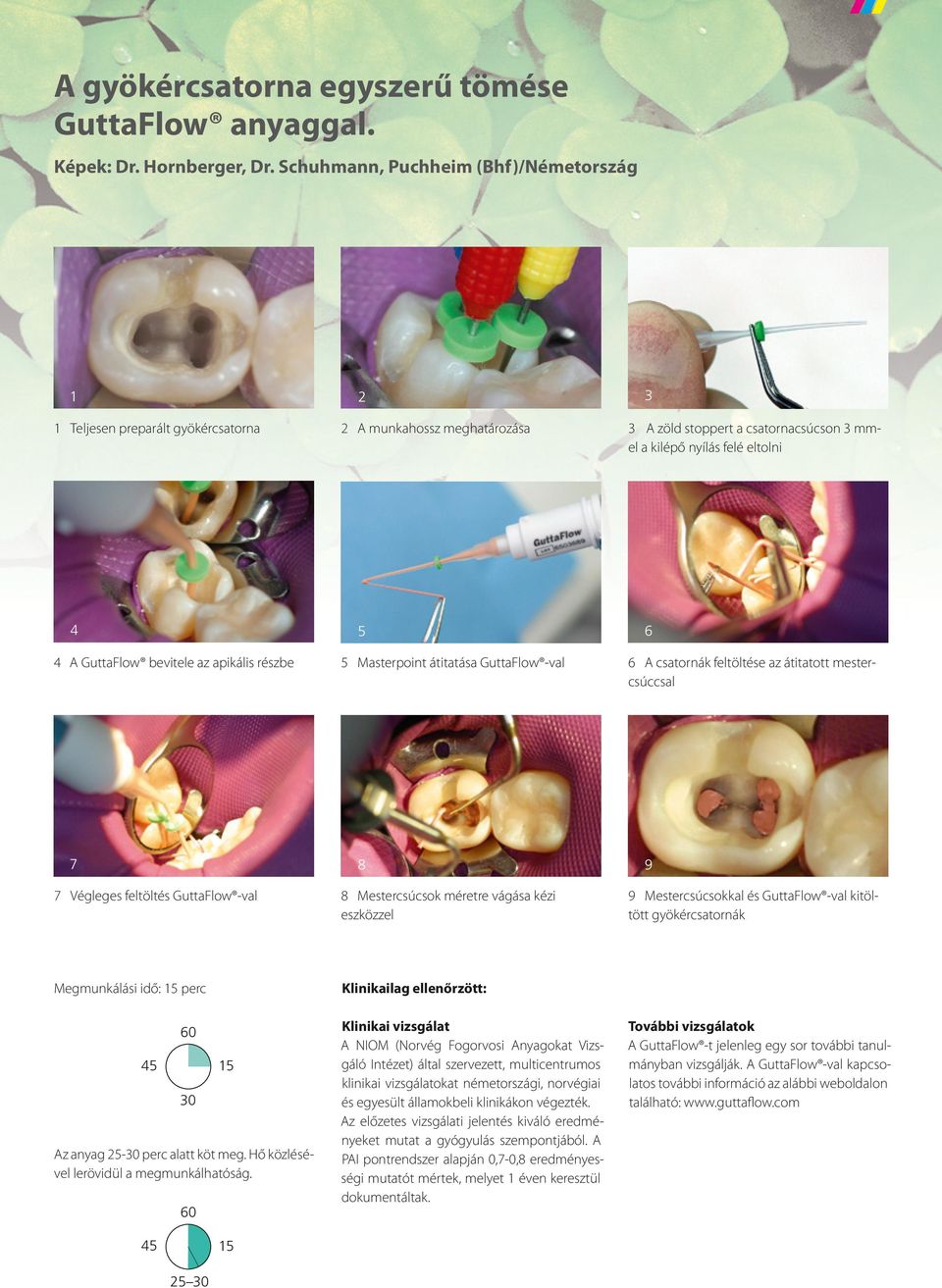 GuttaFlow bevitele az apikális részbe 5 Masterpoint átitatása GuttaFlow -val 6 A csatornák feltöltése az átitatott mestercsúccsal 7 8 9 7 Végleges feltöltés GuttaFlow -val 8 Mestercsúcsok méretre