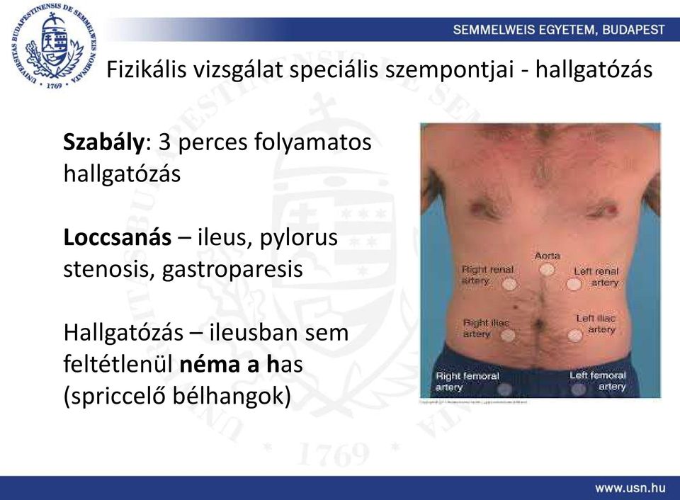 Loccsanás ileus, pylorus stenosis, gastroparesis