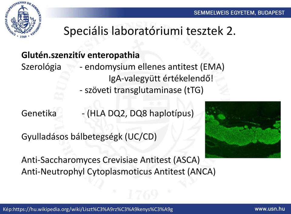 - szöveti transglutaminase (ttg) Genetika - (HLA DQ2, DQ8 haplotípus) Gyulladásos bálbetegségk