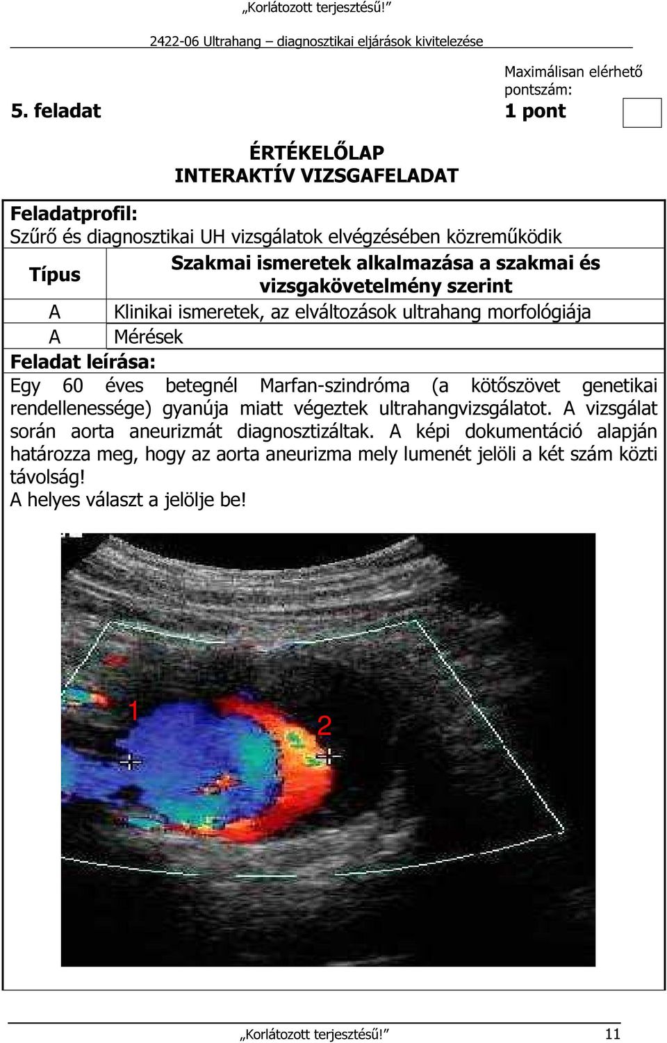 szakmai és vizsgakövetelmény szerint A Klinikai ismeretek, az elváltozások ultrahang morfológiája A Mérések Feladat leírása: Egy 60 éves betegnél Marfan-szindróma (a