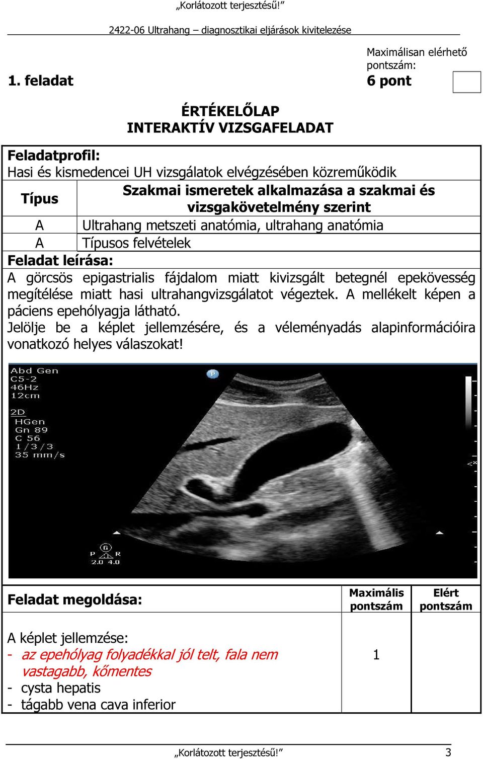 szerint A Ultrahang metszeti anatómia, ultrahang anatómia A Típusos felvételek Feladat leírása: A görcsös epigastrialis fájdalom miatt kivizsgált betegnél epekövesség megítélése miatt hasi