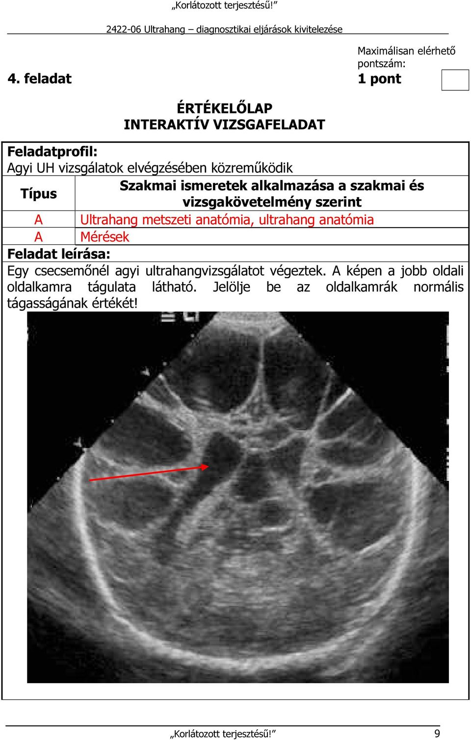 Szakmai ismeretek alkalmazása a szakmai és vizsgakövetelmény szerint A Ultrahang metszeti anatómia, ultrahang anatómia