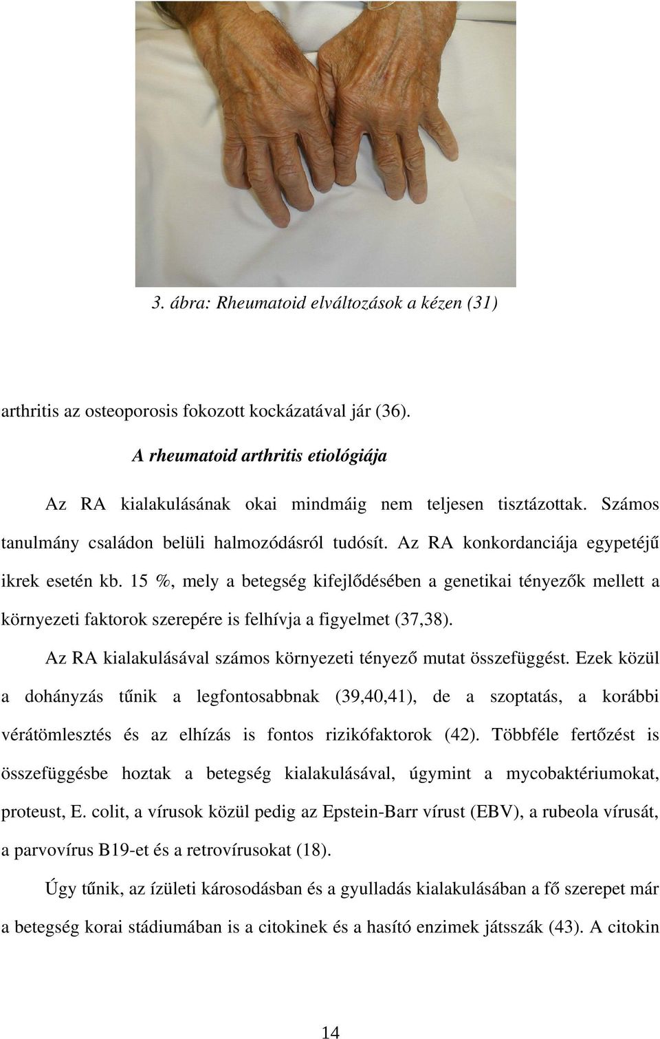 15 %, mely a betegség kifejlődésében a genetikai tényezők mellett a környezeti faktorok szerepére is felhívja a figyelmet (37,38). Az RA kialakulásával számos környezeti tényező mutat összefüggést.