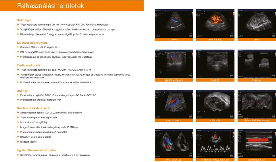 áramlás Mitrális billentyű áramlás Carotis áramlás Szülészet-nőgyógyászat Standard 3D helyreállító képalkotás 200 -os nagylátószögű endocavity vizsgálófej hőmérsékletfigyeléssel Professzionális és