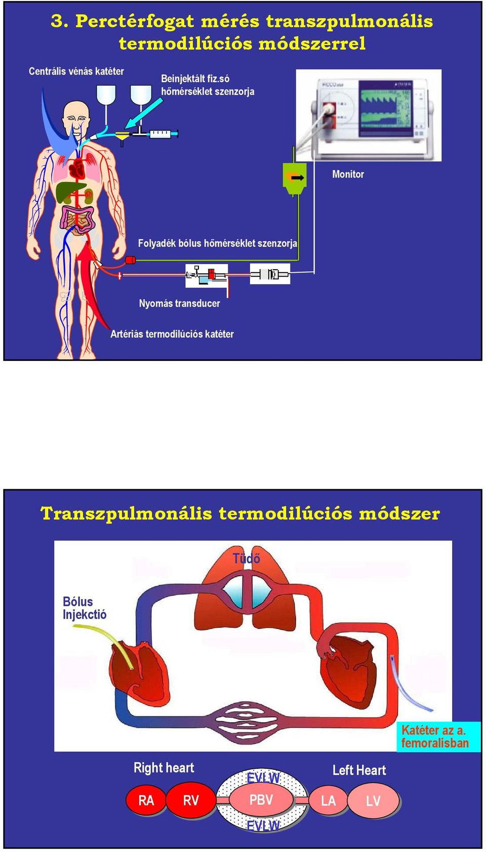 só hőmérséklet szenzorja Monitor Folyadék bólus hőmérséklet szenzorja Nyomás transducer