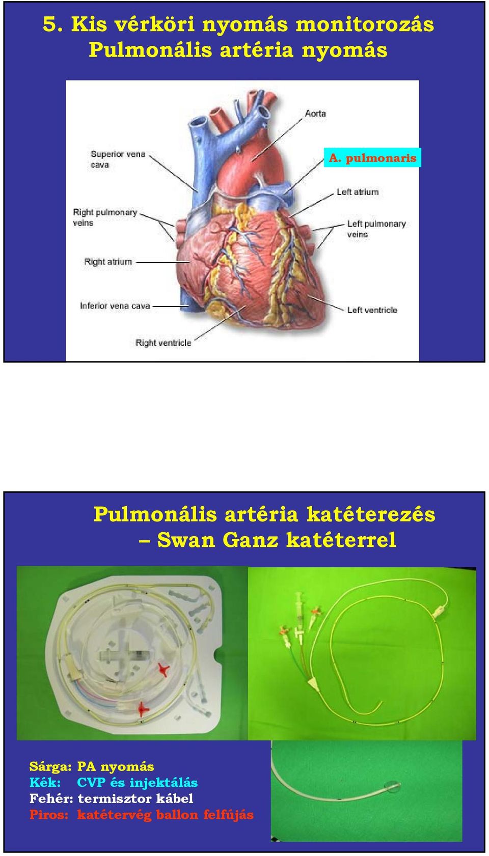 pulmonaris Pulmonális artéria katéterezés Swan Ganz