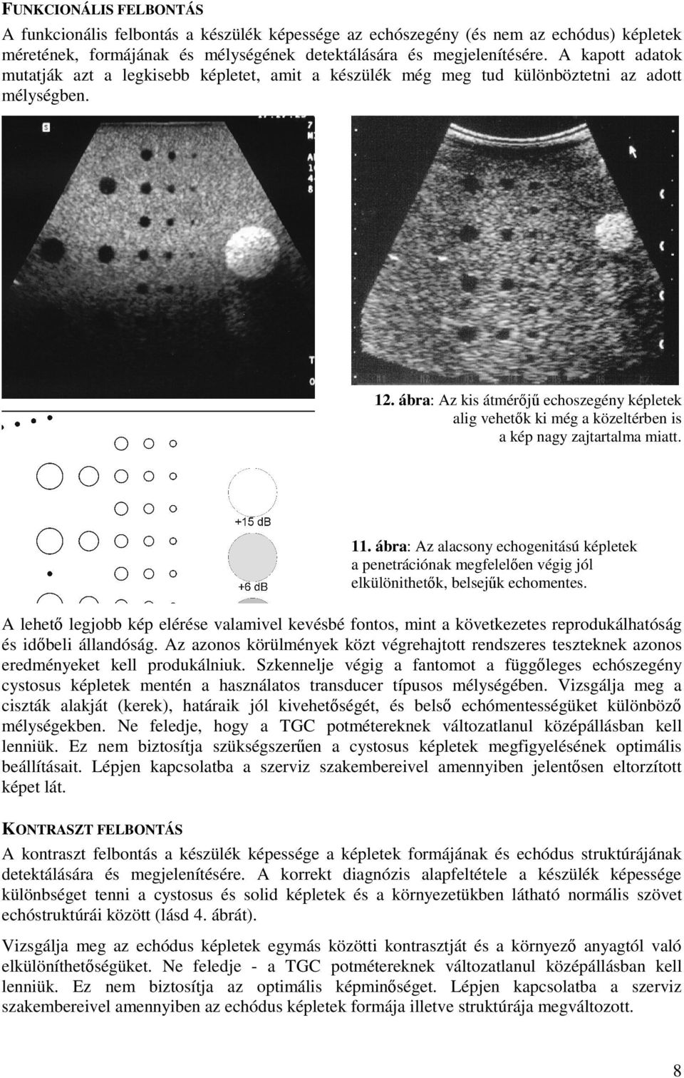 ábra: Az kis átmérÿj echoszegény képletek alig vehetÿk ki még a közeltérben is a kép nagy zajtartalma miatt. 11.