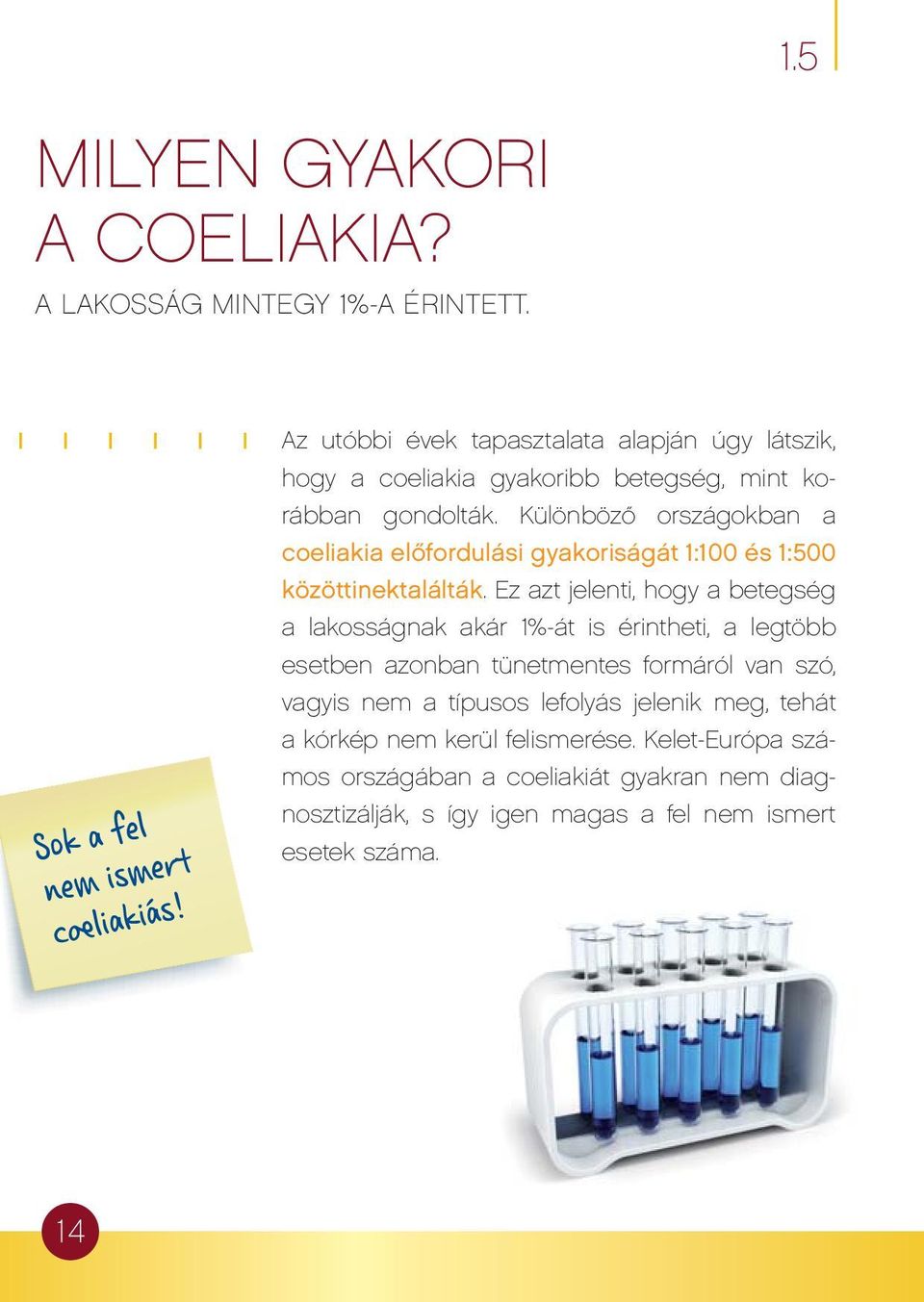 Különböző országokban a coeliakia előfordulási gyakoriságát 1:100 és 1:500 közöttinektalálták.