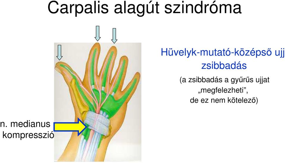 Hüvelyk-mutató-középsı ujj zsibbadás