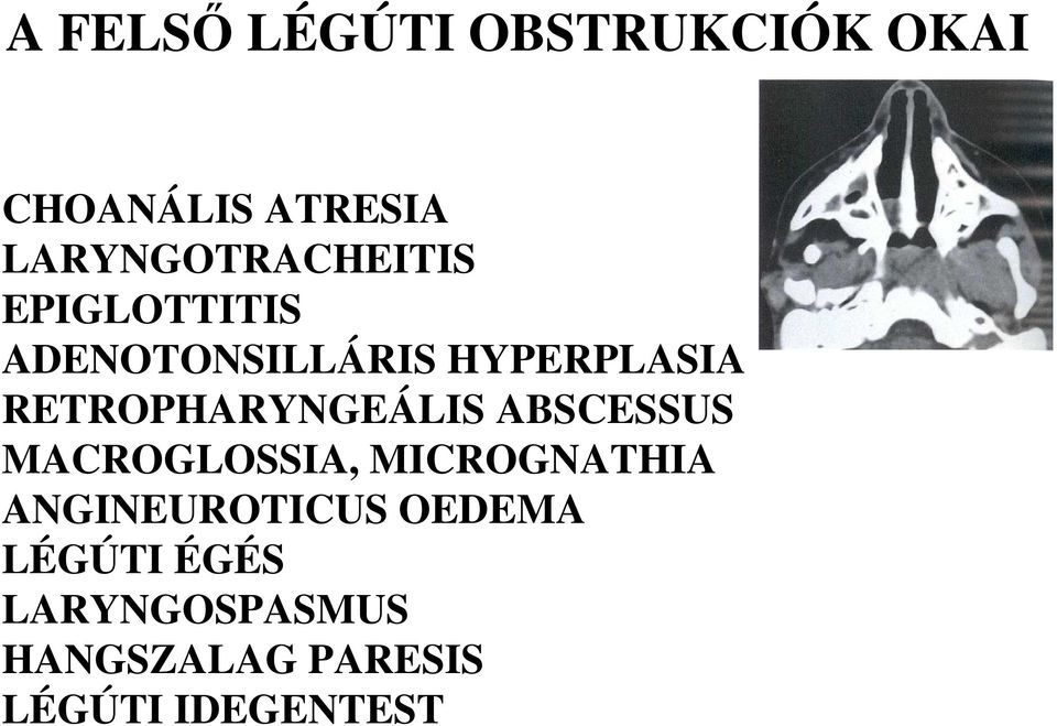 RETROPHARYNGEÁLIS ABSCESSUS MACROGLOSSIA, MICROGNATHIA