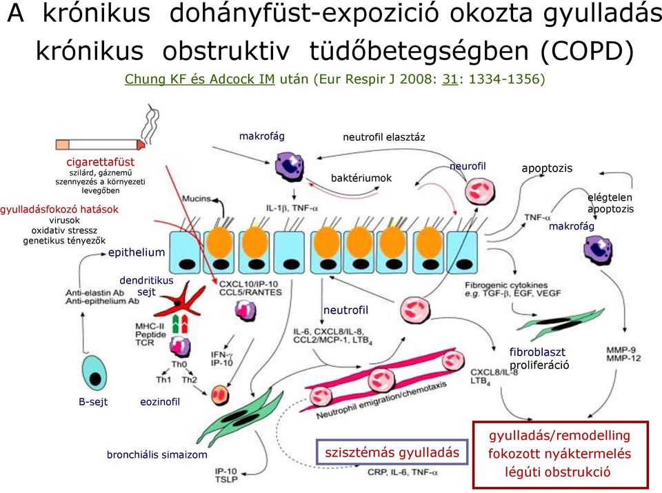 oxidativ stressz genetikus tényezők epithelium baktériumok neurofil apoptozis makrofág elégtelen apoptozis dendritikus sejt neutrofil