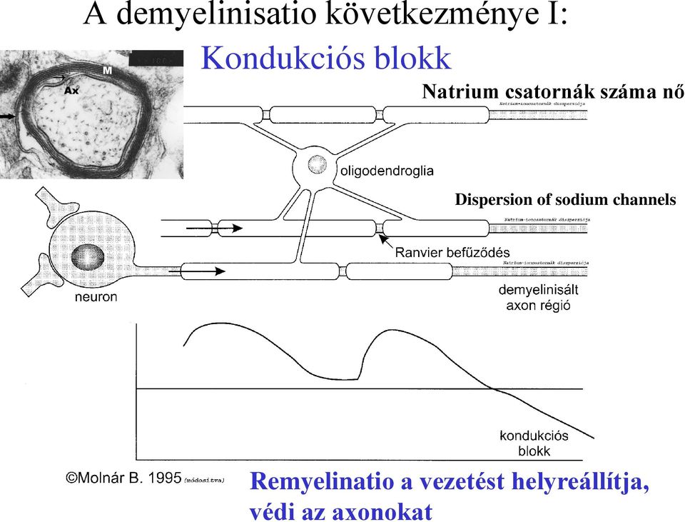 nő Dispersion of sodium channels