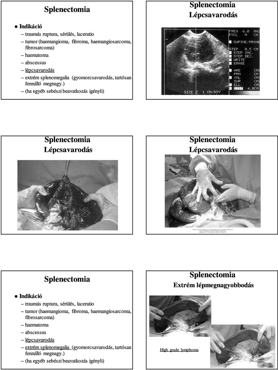 (haemangioma haemangioma, fibroma,