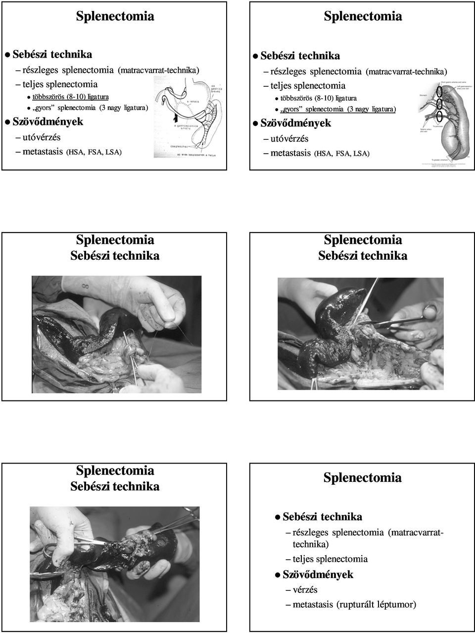 utóvérzés metastasis metastasis (HSA, FSA, LSA) részleges splenectomia (matracvarrat- technika) teljes splenectomia