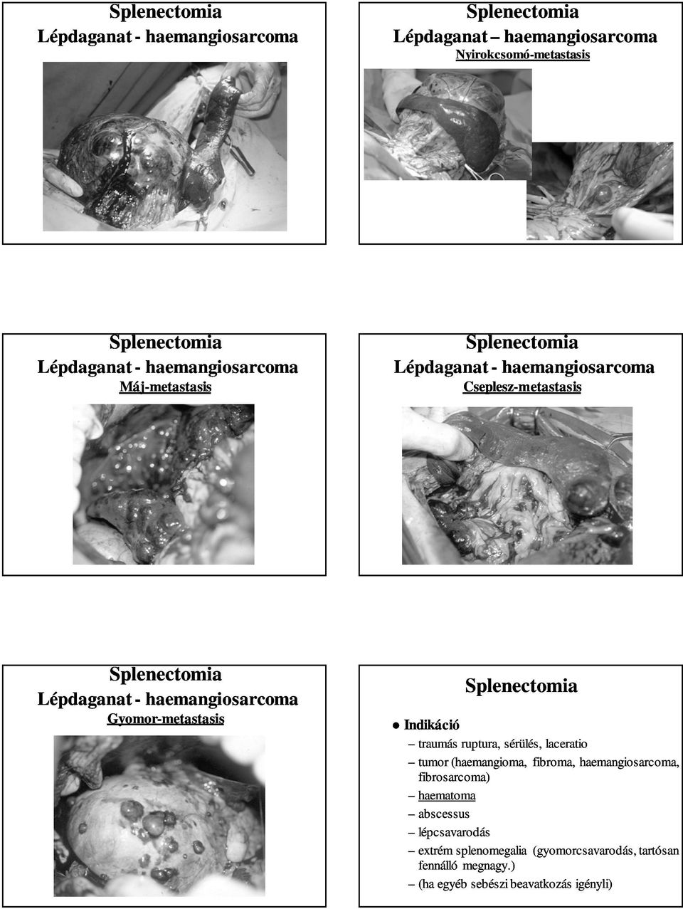 Máj-metastasis Lépdaganat - haemangiosarcoma Cseplesz-metastasis