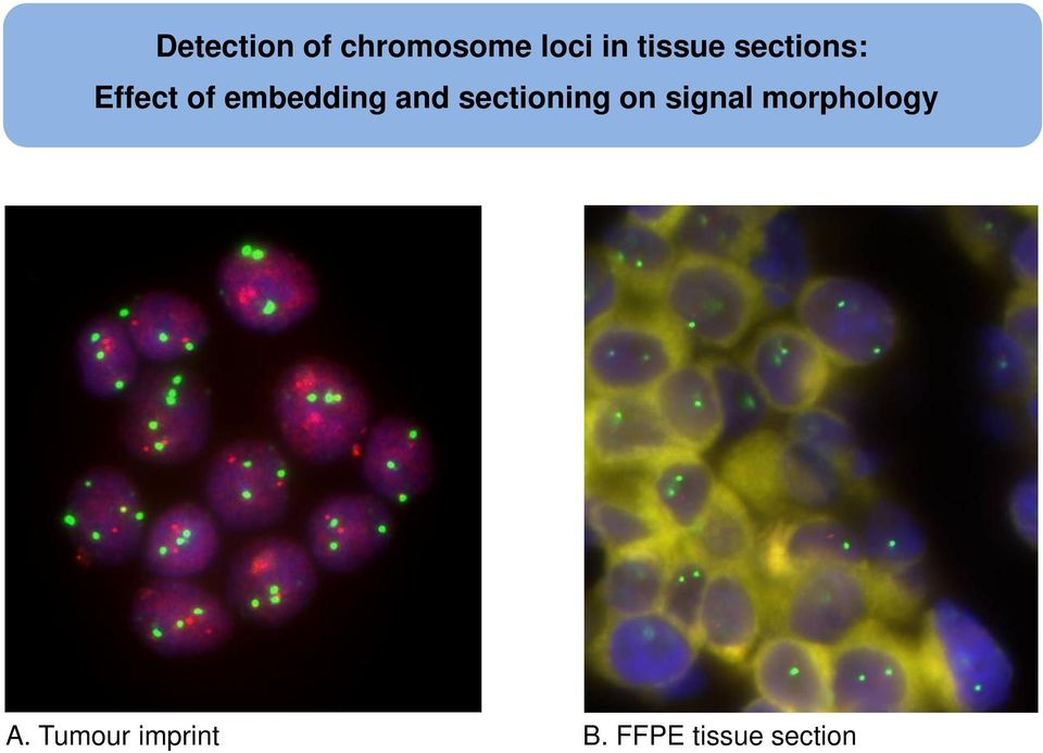 and sectioning on signal morphology