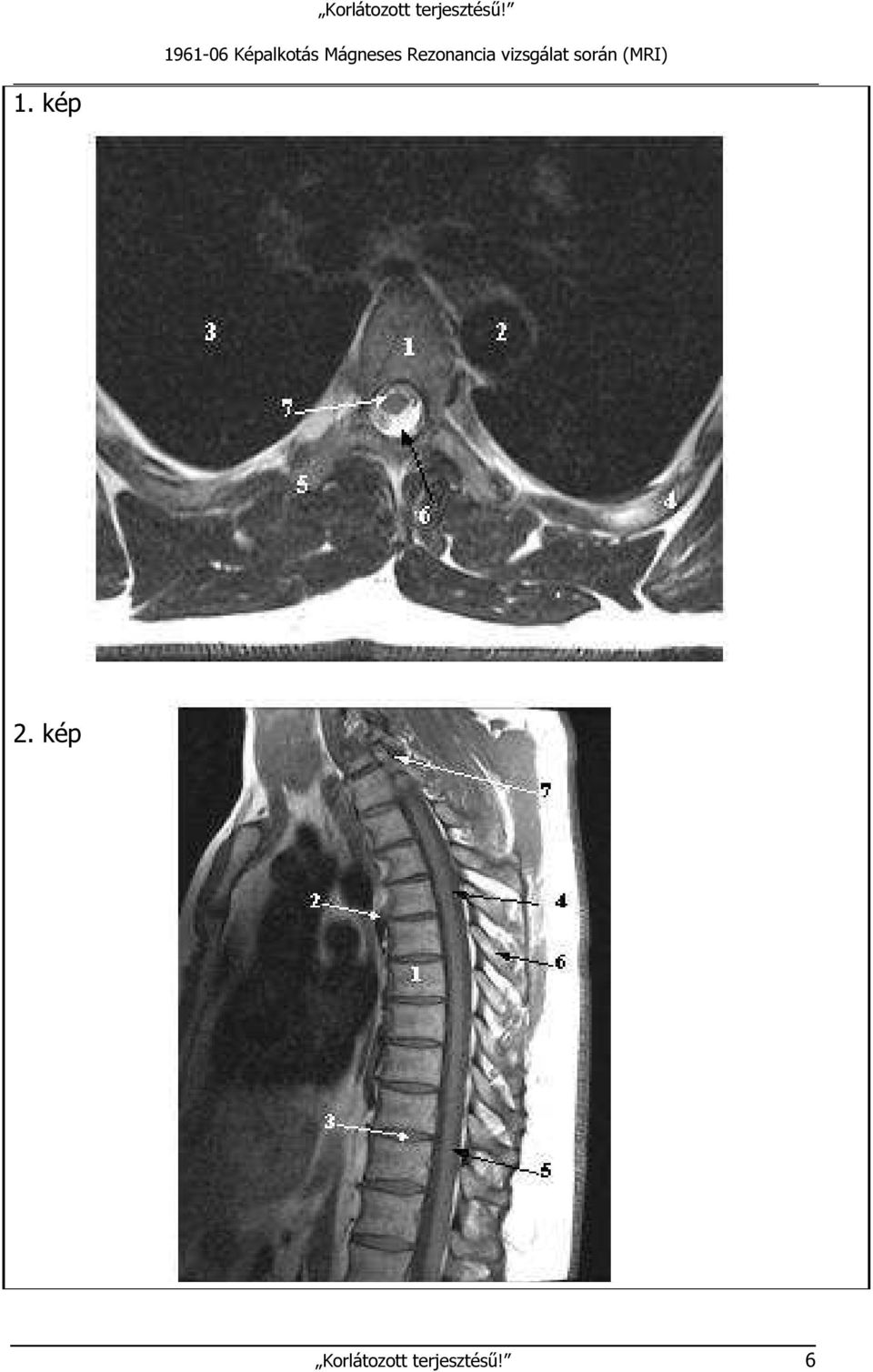 vizsgálat során (MRI).