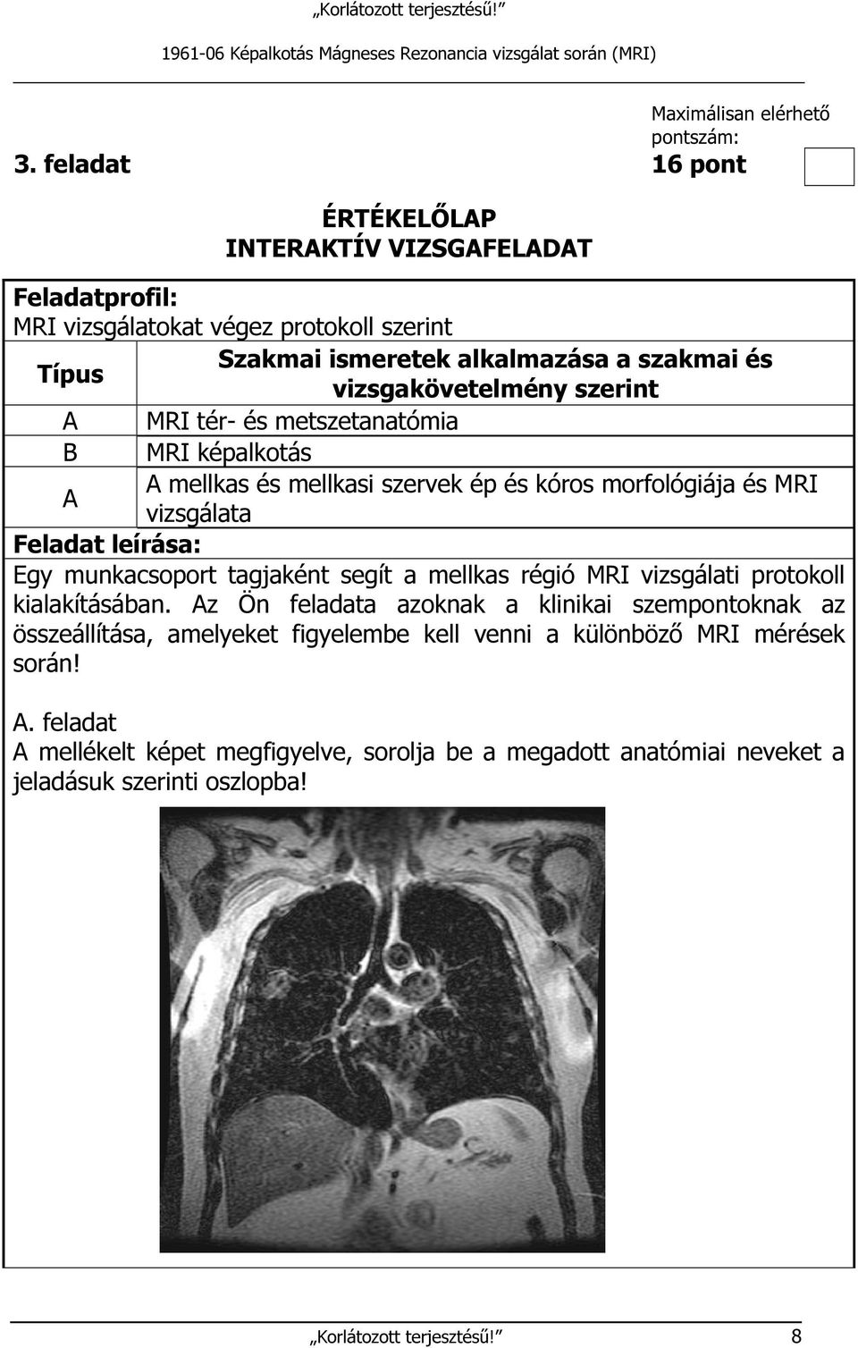 tér- és metszetanatómia B MRI képalkotás A mellkas és mellkasi szervek ép és kóros morfológiája és MRI A vizsgálata Feladat leírása: Egy munkacsoport tagjaként segít a mellkas régió MRI