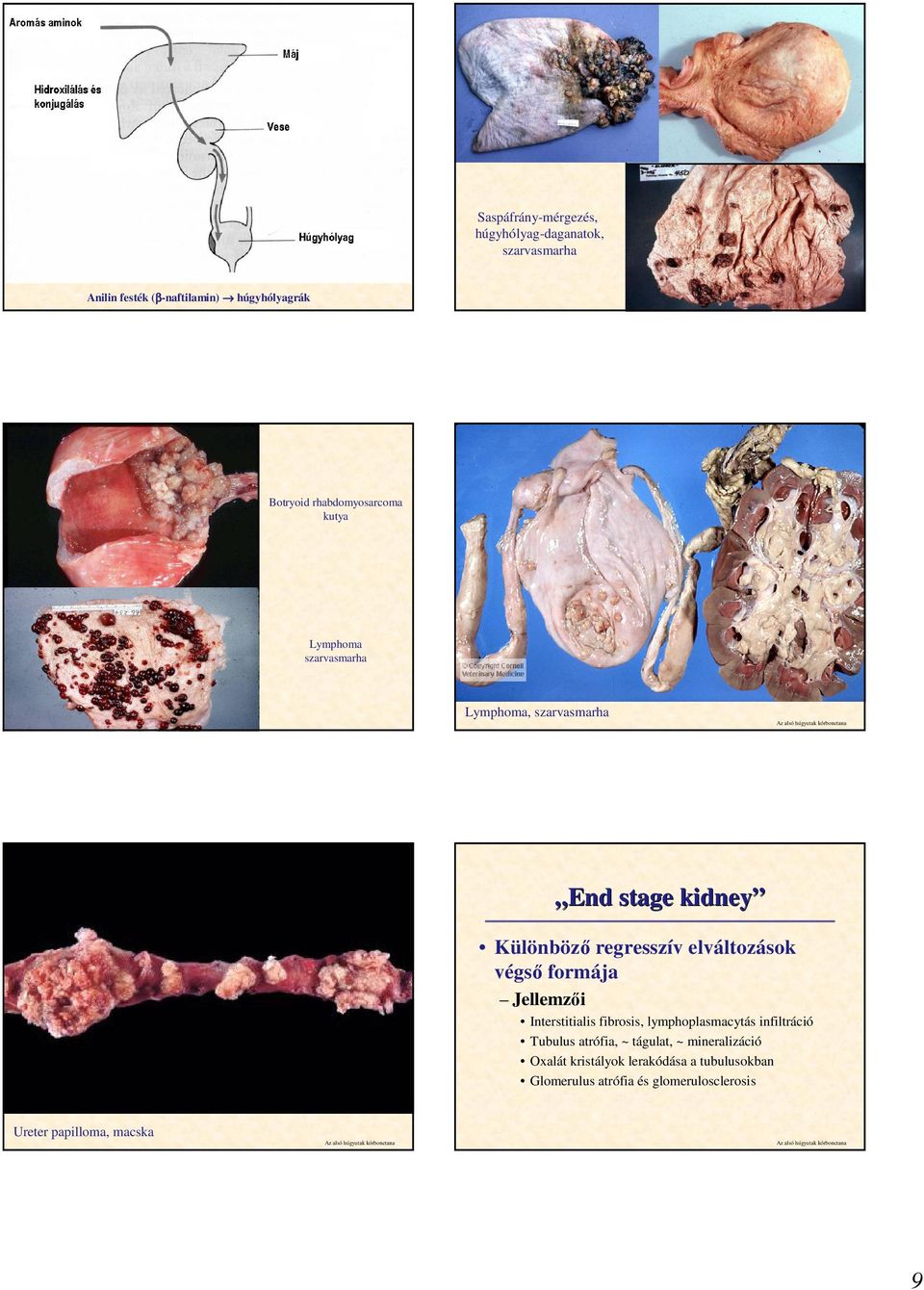 elváltozások végsı formája Jellemzıi Interstitialis fibrosis, lymphoplasmacytás infiltráció Tubulus atrófia, ~