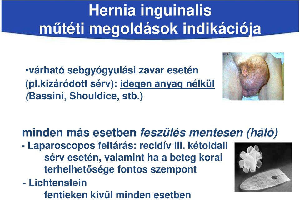 ) minden más esetben feszülés mentesen (háló) - Laparoscopos feltárás: recidív ill.