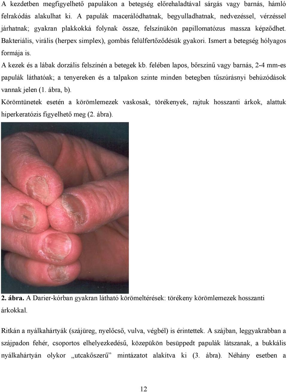 Bakteriális, virális (herpex simplex), gombás felülfertőződésük gyakori. Ismert a betegség hólyagos formája is. A kezek és a lábak dorzális felszínén a betegek kb.