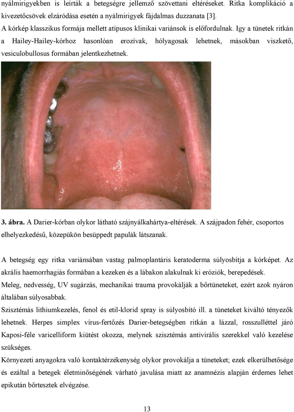 Igy a tünetek ritkán a Hailey-Hailey-kórhoz hasonlóan erozívak, hólyagosak lehetnek, másokban viszkető, vesiculobullosus formában jelentkezhetnek. 3. ábra.