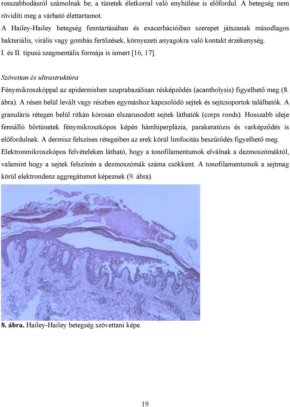 típusú szegmentális formája is ismert [16, 17]. Szövettan és ultrastruktúra Fénymikroszkóppal az epidermisben szuprabazálisan résképződés (acantholysis) figyelhető meg (8. ábra).