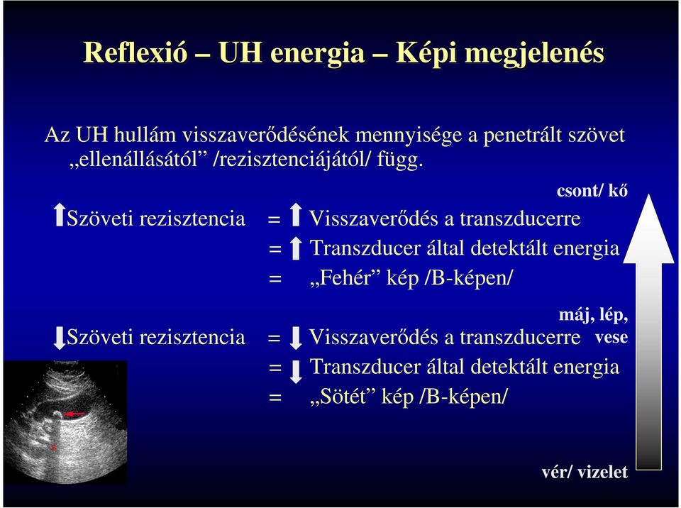 Szöveti rezisztencia Szöveti rezisztencia csont/ kő = Visszaverődés a transzducerre = Transzducer