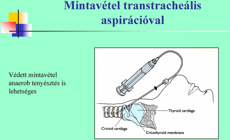 aspirációval Védett