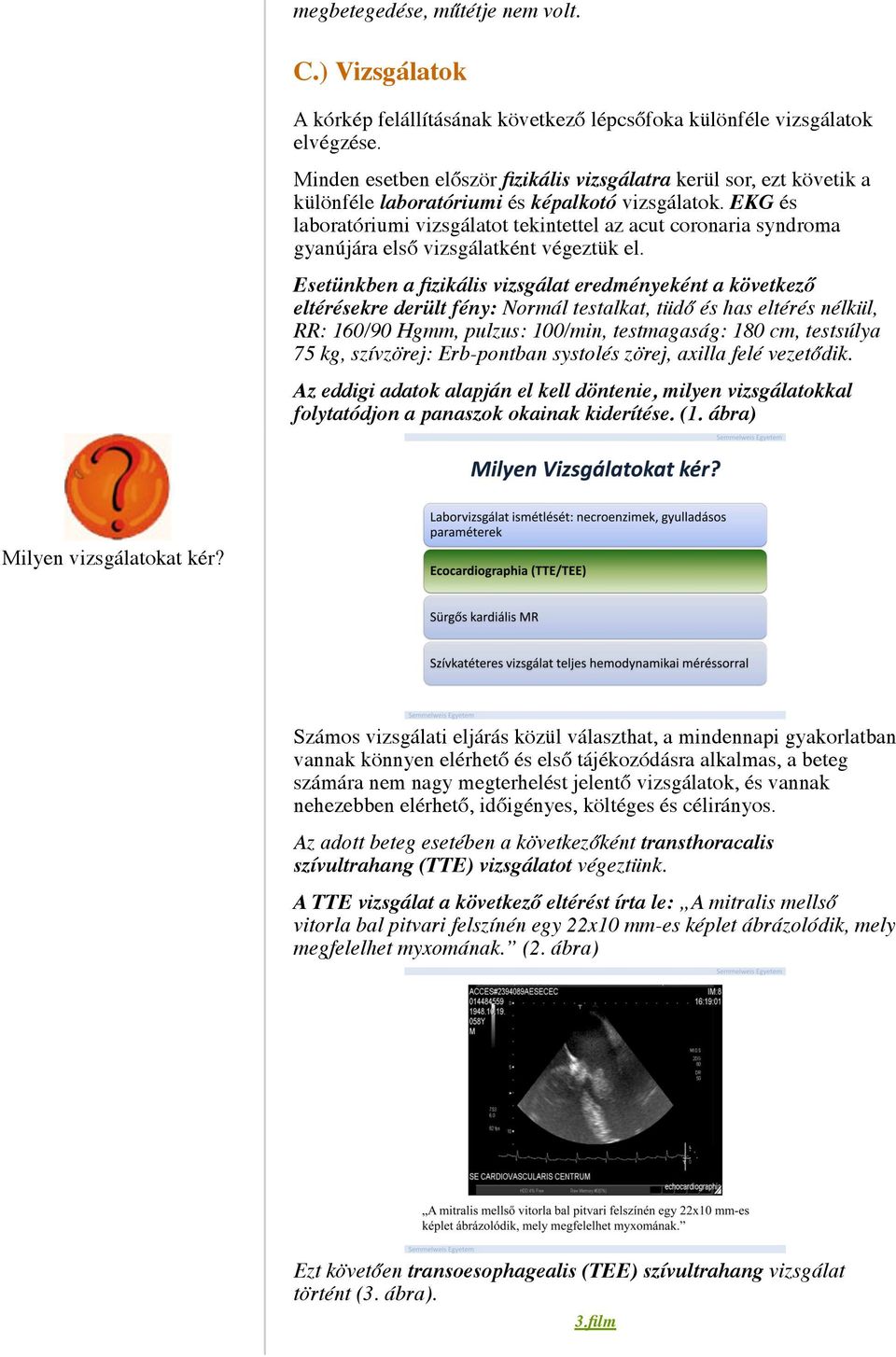 EKG és laboratóriumi vizsgálatot tekintettel az acut coronaria syndroma gyanújára első vizsgálatként végeztük el.