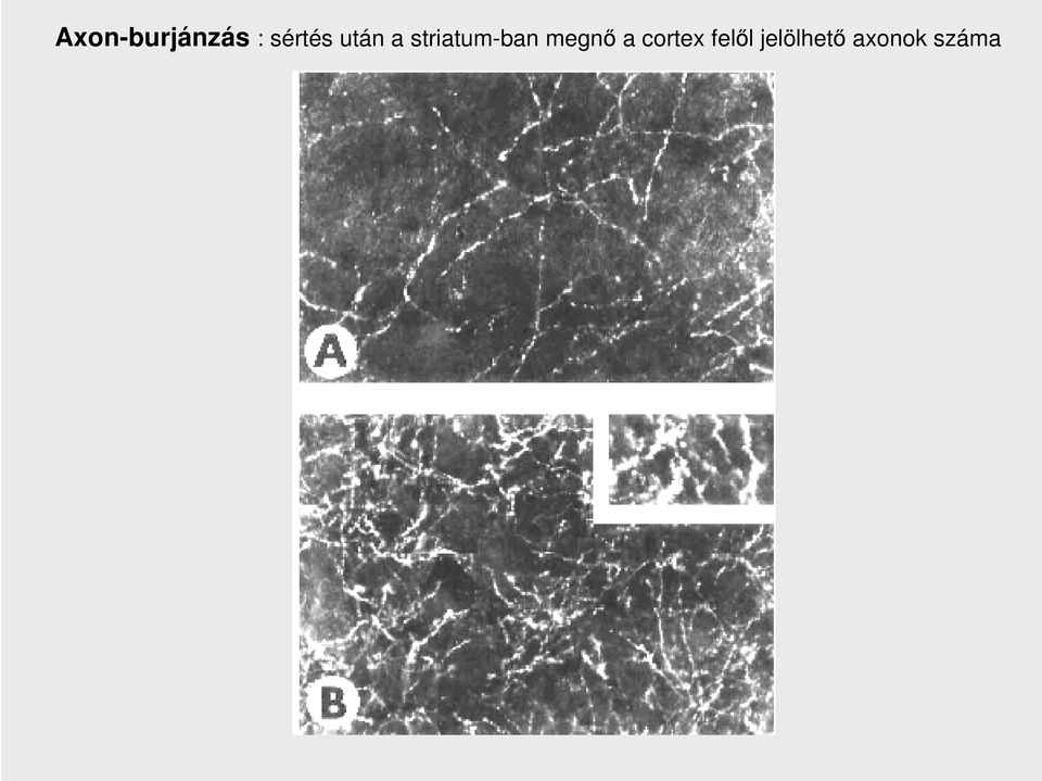 striatum-ban megnı a