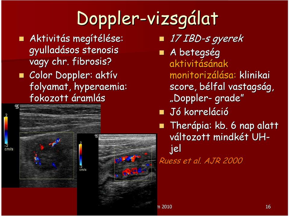 aktivitásának monitorizálása sa: klinikai score,, bélfal b vastagság, g, Doppler- grade Jó