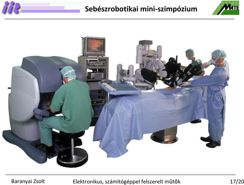 laparoszkópia megjelenése tette 15 évvel ezelőtt jobb kézügyesség, 3D-s