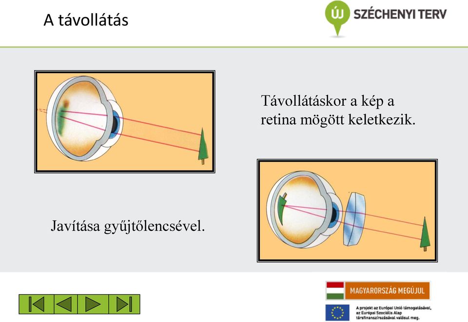 retina mögött