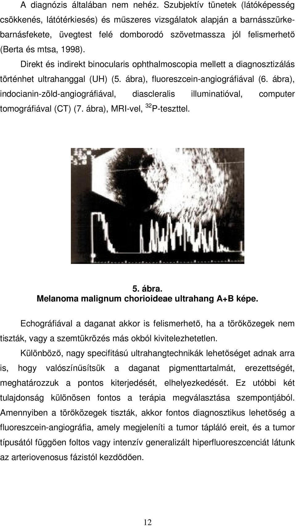 Direkt és indirekt binocularis ophthalmoscopia mellett a diagnosztizálás történhet ultrahanggal (UH) (5. ábra), fluoreszcein-angiográfiával (6.