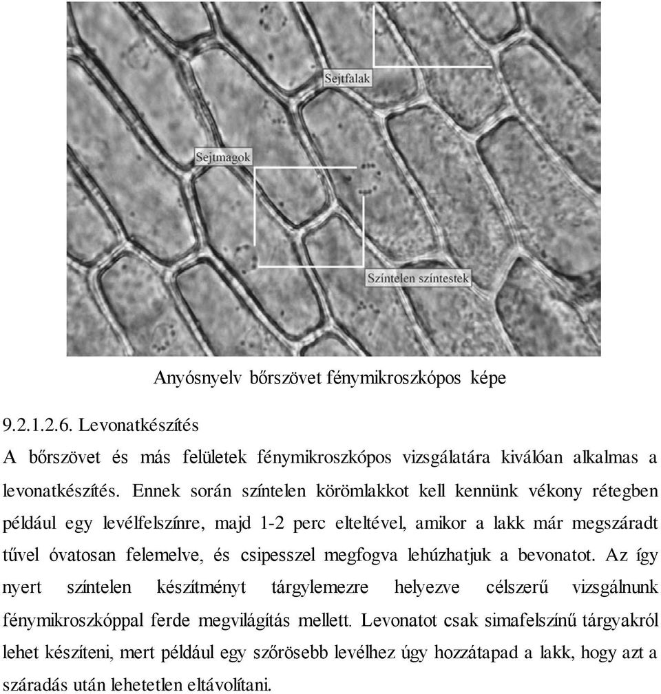 felemelve, és csipesszel megfogva lehúzhatjuk a bevonatot.