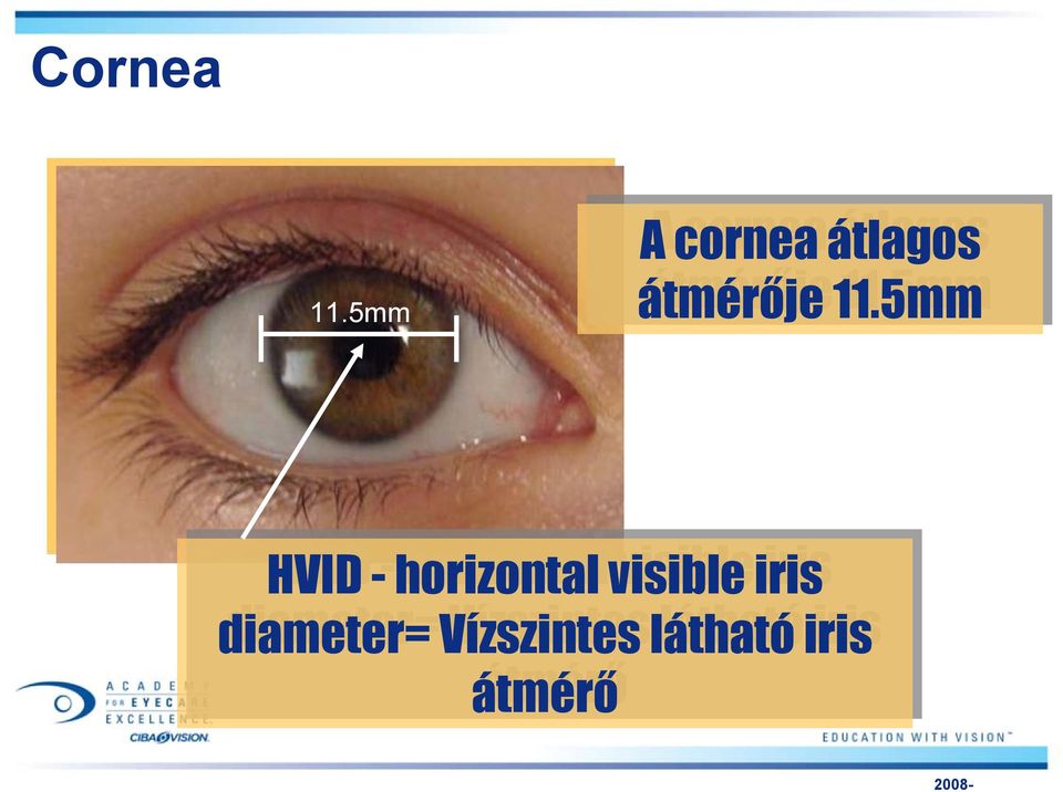 11.5mm HVID - horizontal