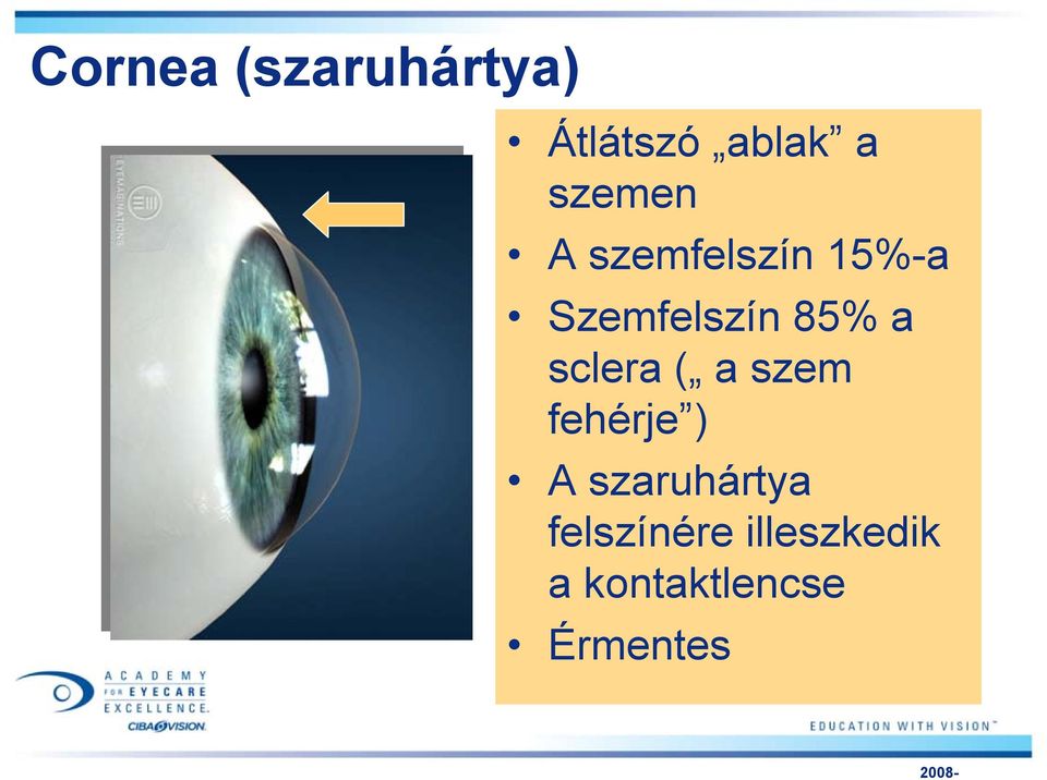 a sclera ( a szem fehérje ) A szaruhártya