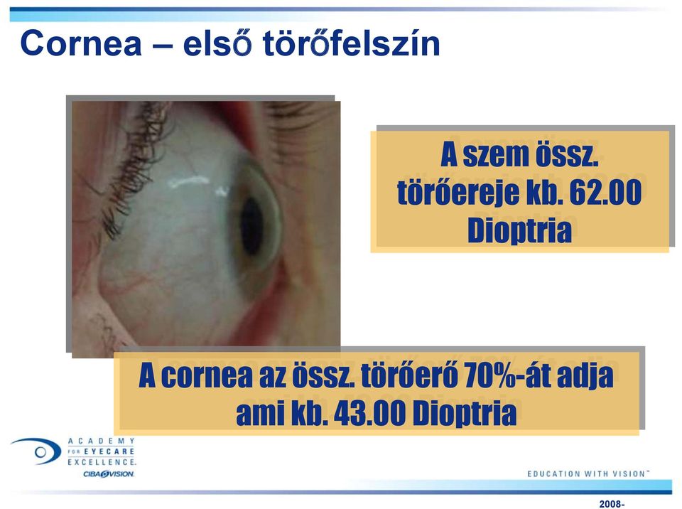 00 Dioptria A cornea az össz.