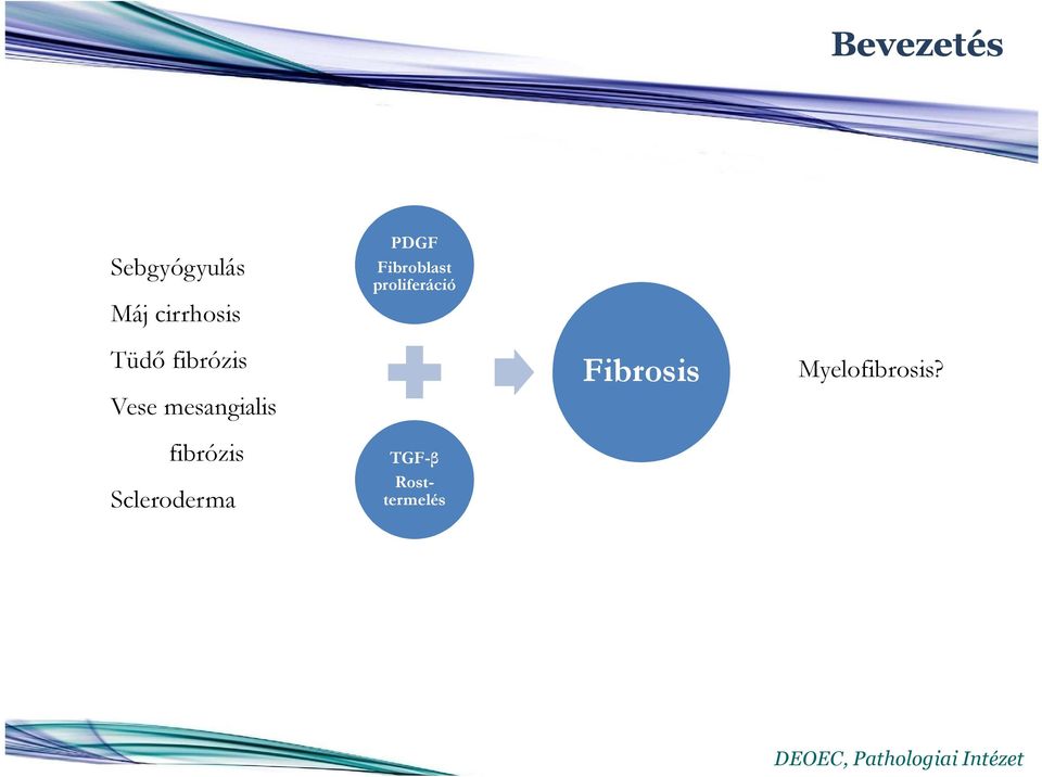 Scleroderma PDGF Fibroblast