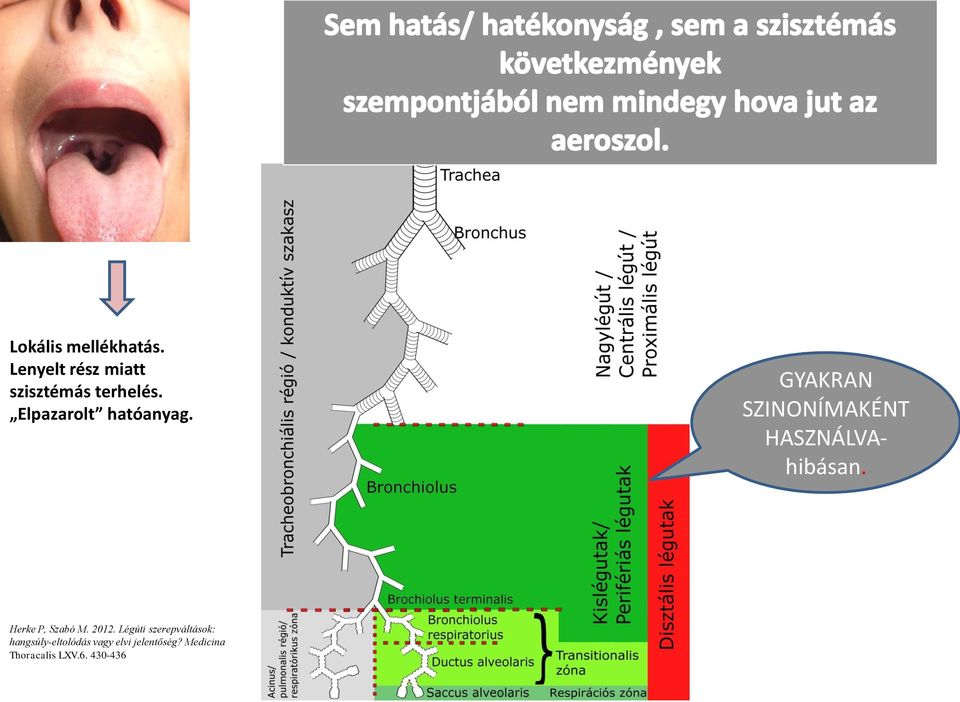 Herke P, Szabó M. 2012.