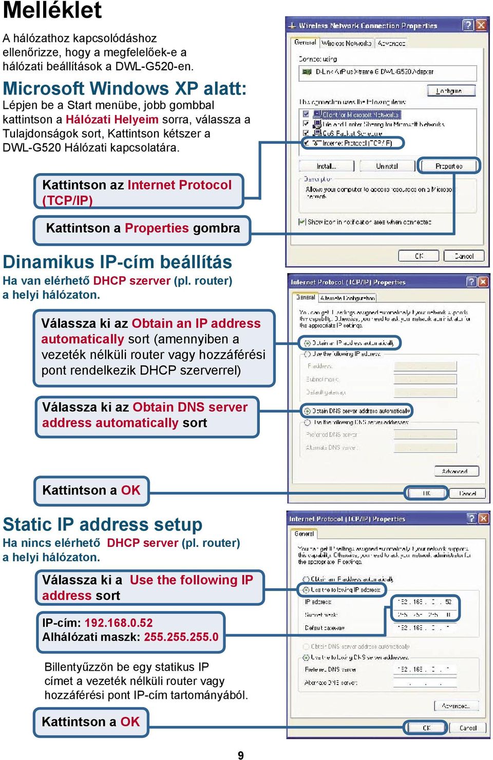 Kattintson az Internet Protocol (TCP/IP) Kattintson a Properties gombra Dinamikus IP-cím beállítás Ha van elérhető DHCP szerver (pl. router) a helyi hálózaton.