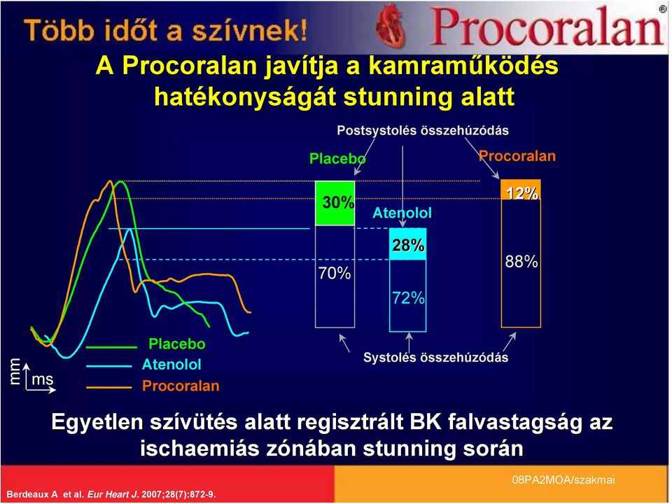 Atenolol Procoralan Systolés összehúzódás Egyetlen szívütés alatt regisztrált BK