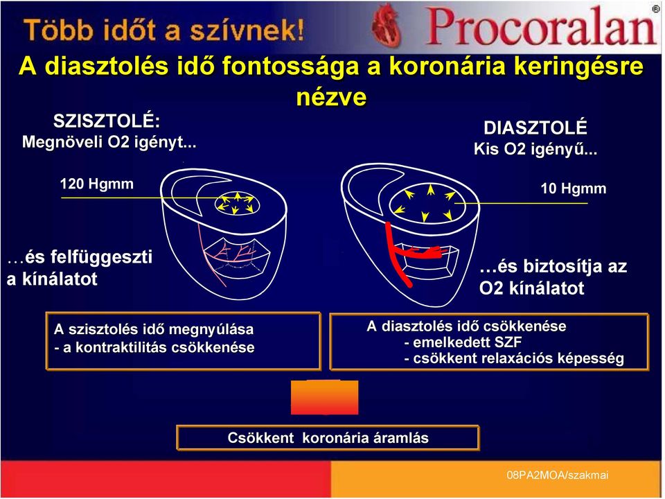 .. 120 Hgmm 10 Hgmm és felfüggeszti a kínálatot A szisztolés idő megnyúlása - a