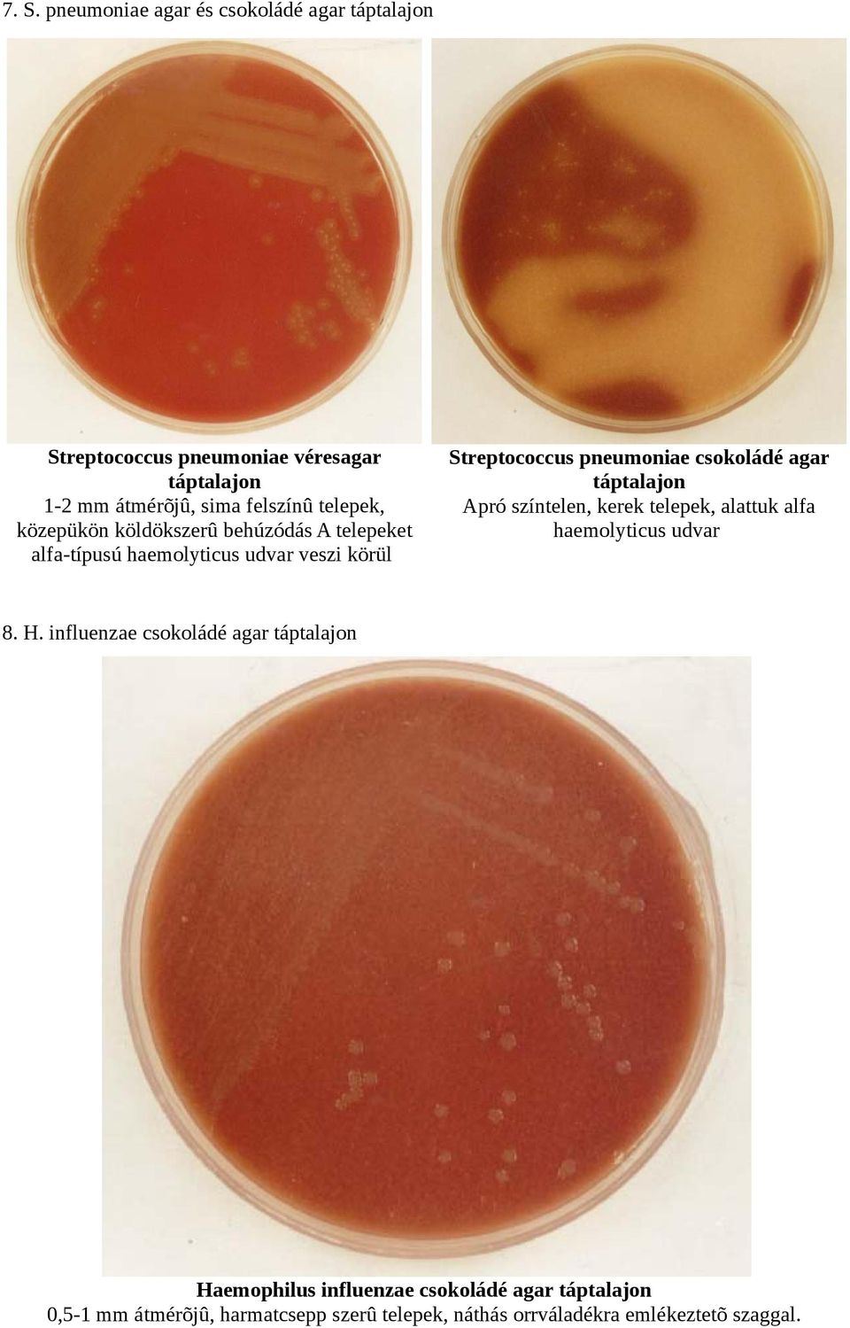 csokoládé agar táptalajon Apró színtelen, kerek telepek, alattuk alfa haemolyticus udvar 8. H.