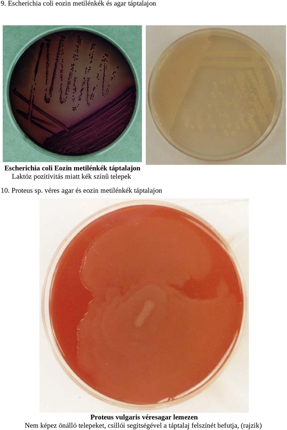 véres agar és eozin metilénkék táptalajon Proteus vulgaris véresagar lemezen Nem